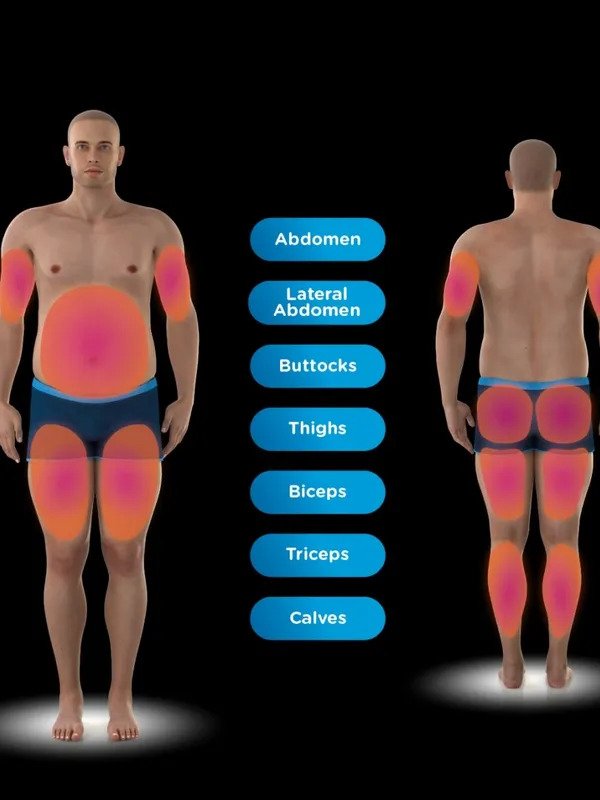 Emsculpt Neo applicator options
